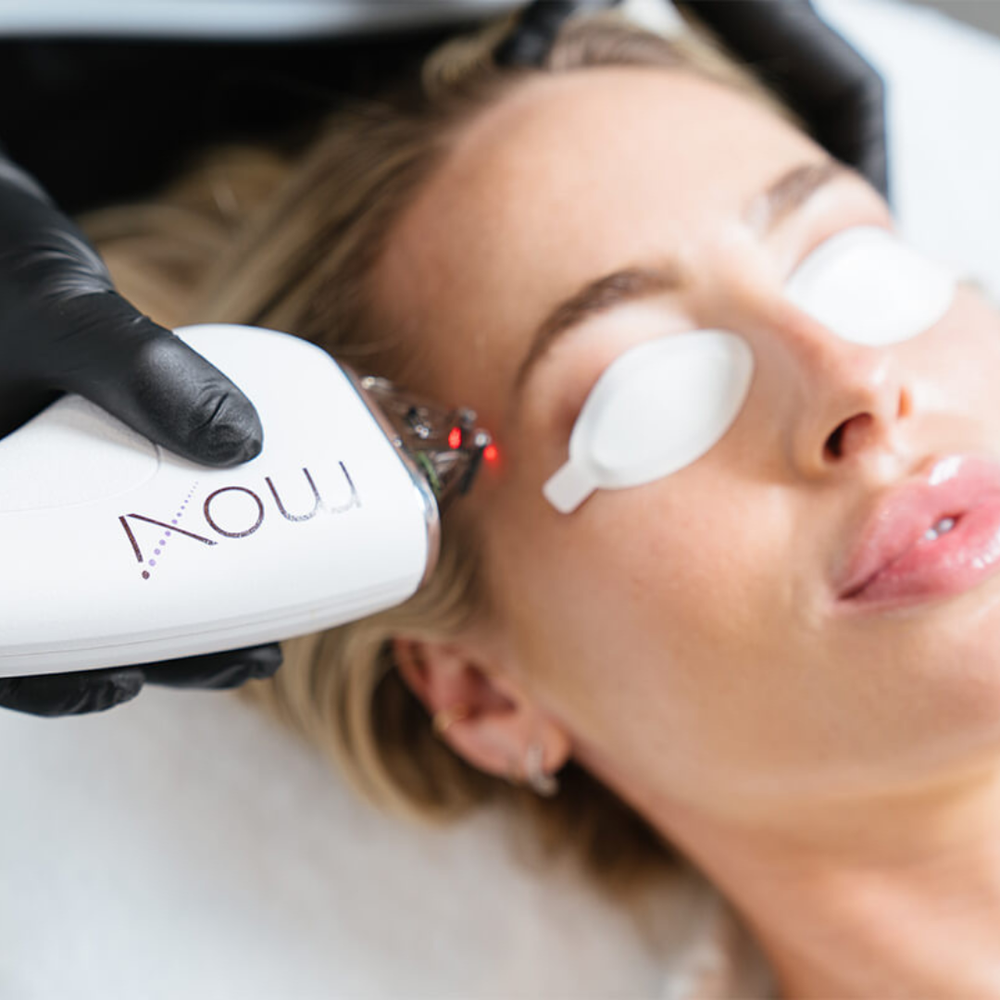 How to Prepare Your Skin for Fall Laser Treatments in Arizona